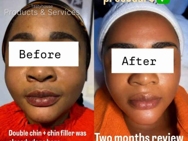 gbglow_aesthetics