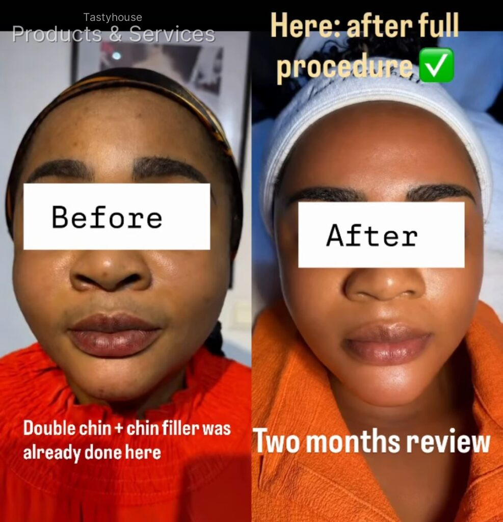 gbglow_aesthetics