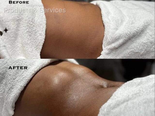 peltaaestheticclinic (cavitation and G5 lymphatic drainage massage)
