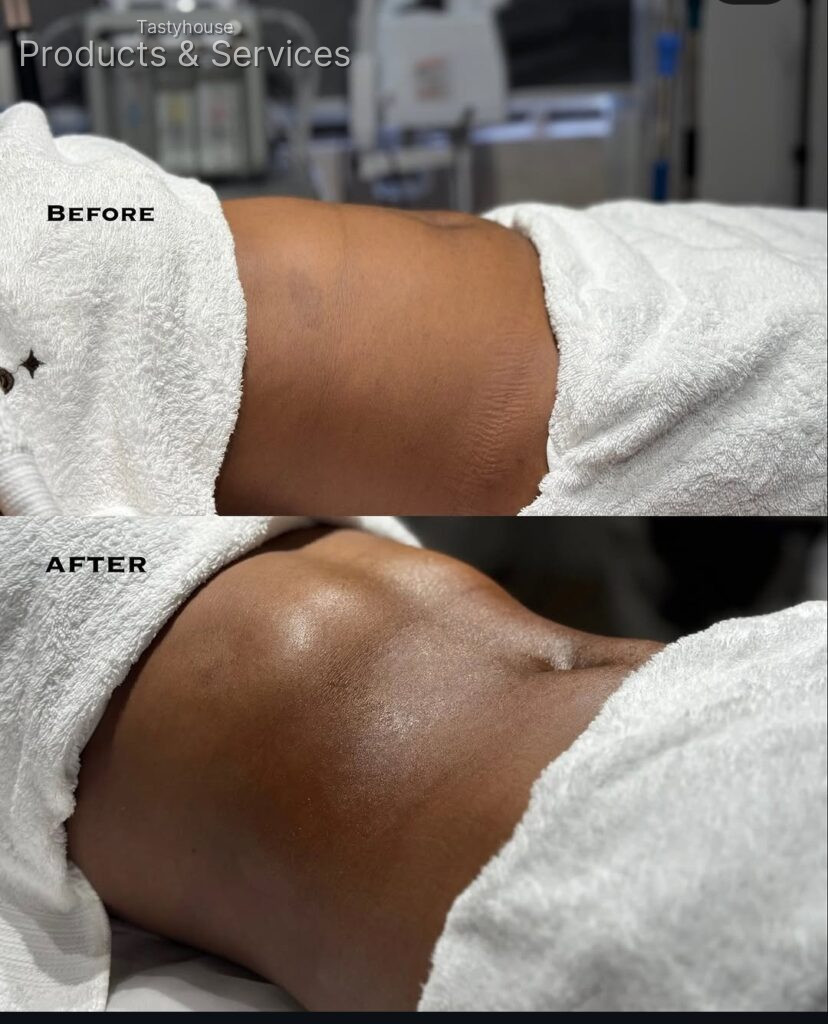 peltaaestheticclinic (cavitation and G5 lymphatic drainage massage)